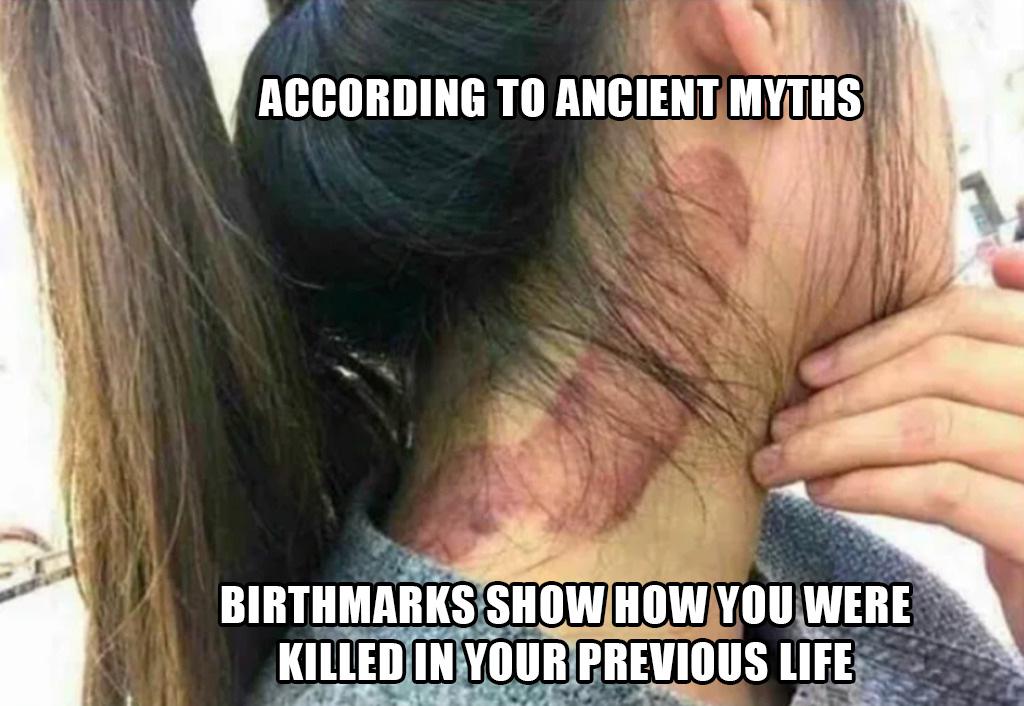 birth mark on penis - According To Ancient Myths Birthmarks Show How You Were Killed In Your Previous Life