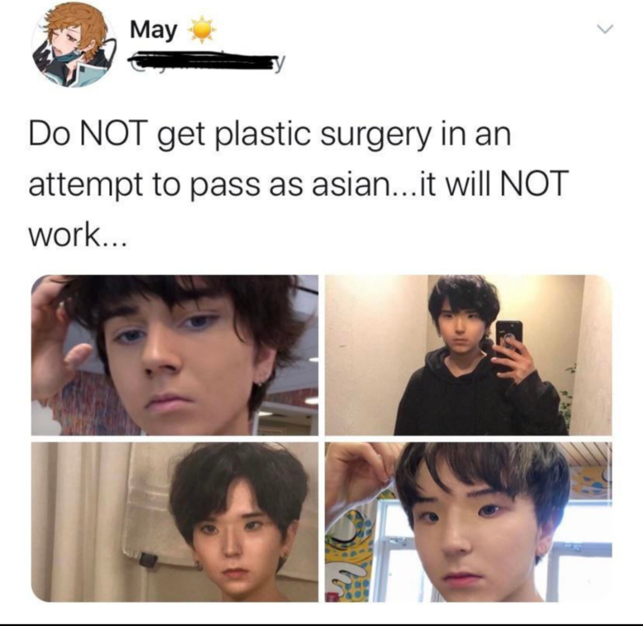 asiaboo - May Do Not get plastic surgery in an attempt to pass as asian... it will Not work...