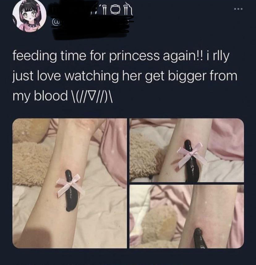 cringe pics - wtf pics - nail - iron w feeding time for princess again!! i rlly just love watching her get bigger from my blood \\