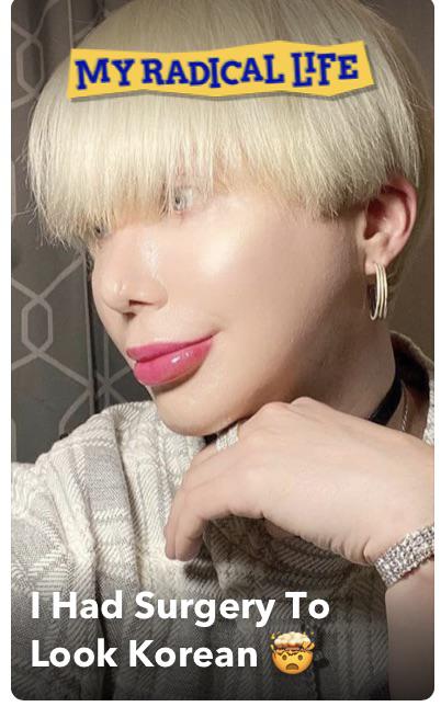 cringe pics - wtf pics - oli london blonde - My Radical Life T Had Surgery To Look Korean