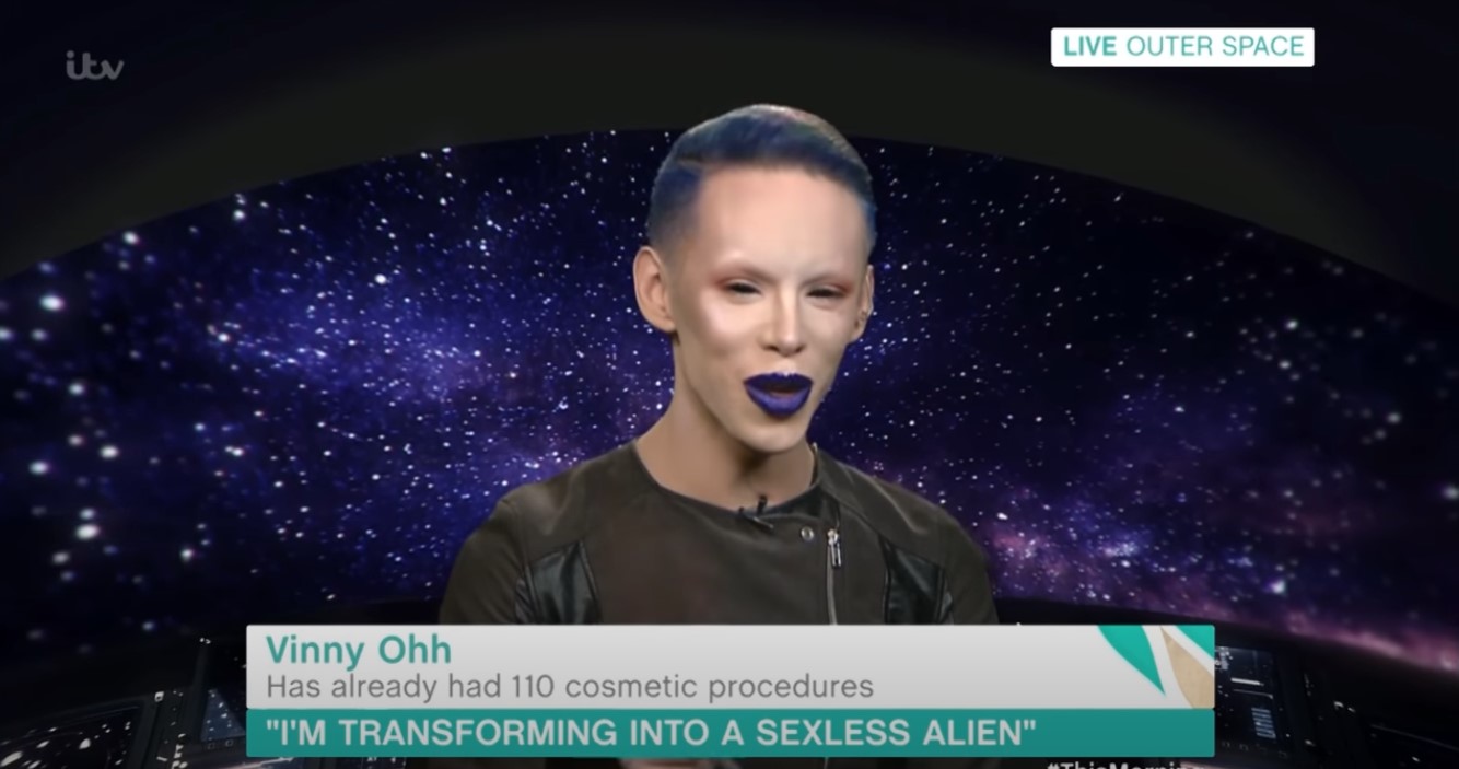 music artist - Live Outer Space itu Vinny Ohh Has already had 110 cosmetic procedures "I'M Transforming Into A Sexless Alien" Tl
