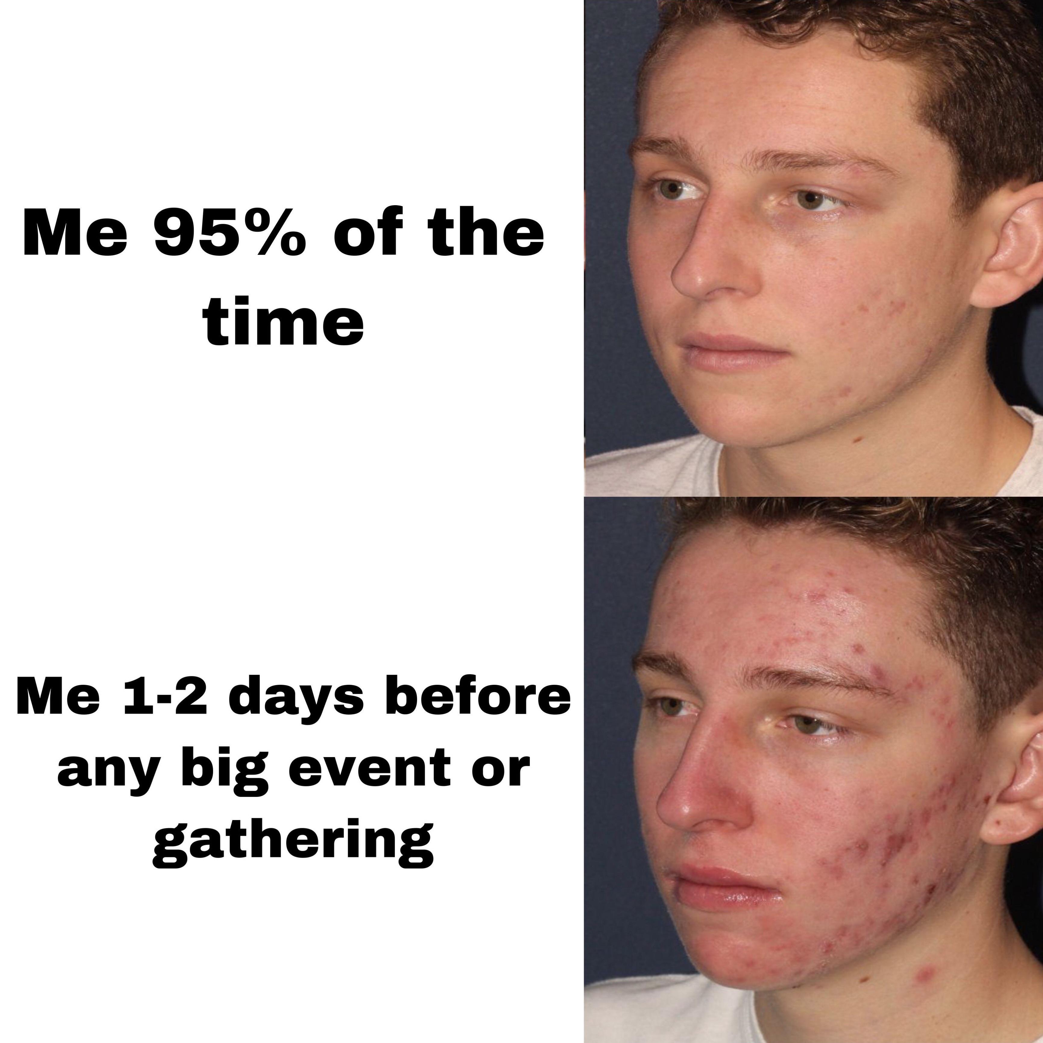 Me 95% of the time Me 12 days before any big event or gathering