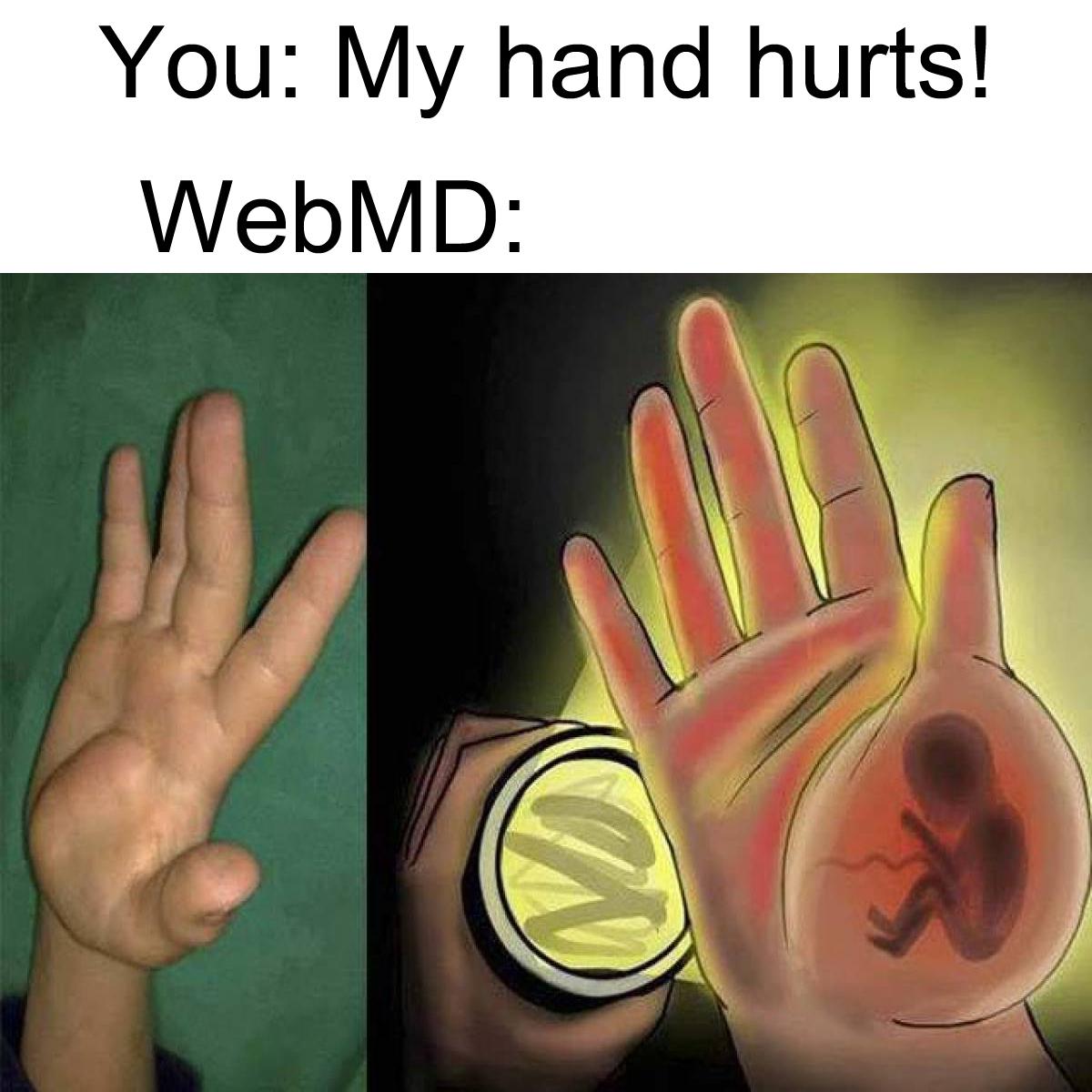 dank memes - funny memes - web 2.0 - You My hand hurts! WebMD
