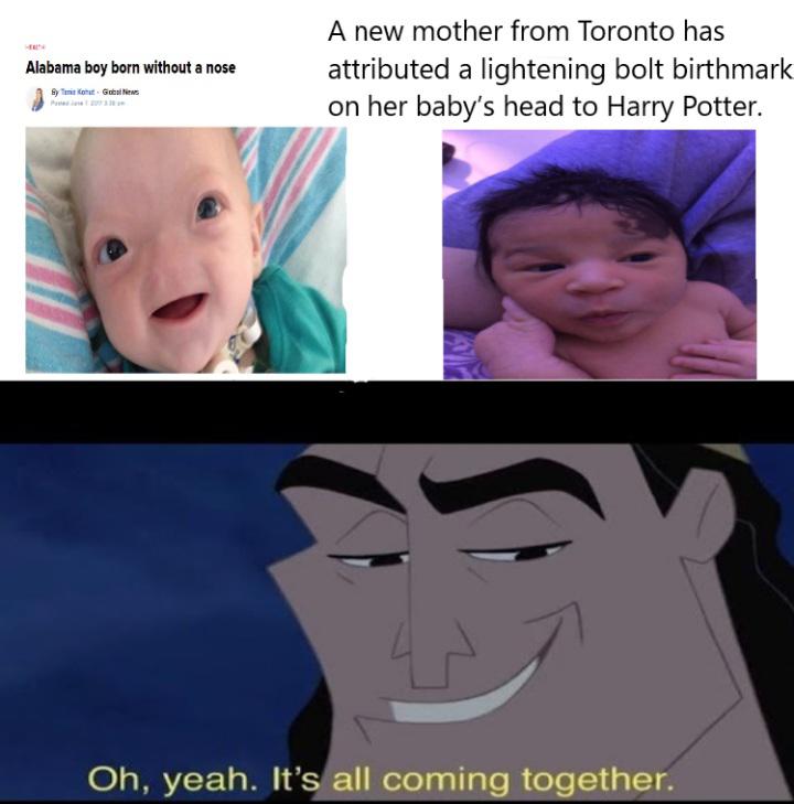 dank memes - funny memes - head - A new mother from Toronto has attributed a lightening bolt birthmark on her baby's head to Harry Potter. Alabama boy born without a nose ByKoGoNews Oh, yeah. It's all coming together.
