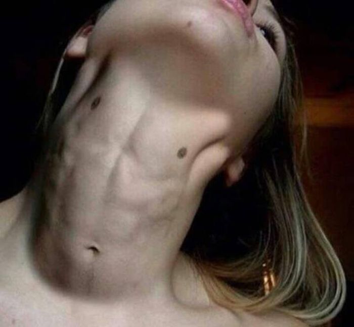 neck