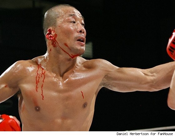 MMA fighter looses ear!