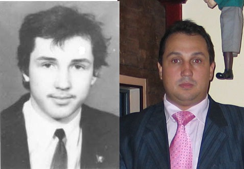 20 Years Before  After