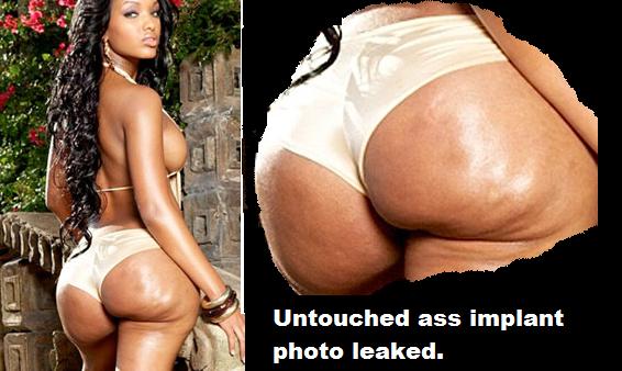 implika - Untouched ass implant photo leaked.
