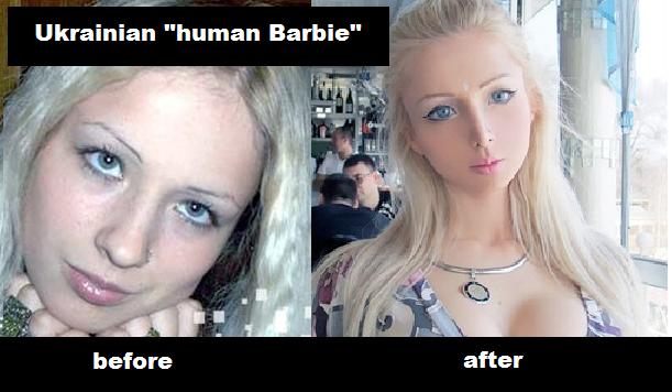 living barbie - Ukrainian "human Barbie" before after