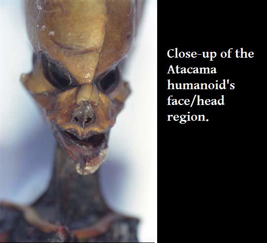 Closeup of the Atacama humanoid's facehead region.