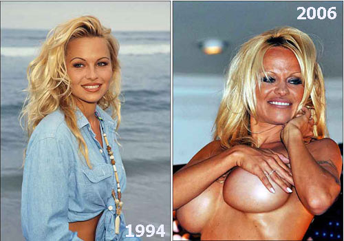 Pam Anderson