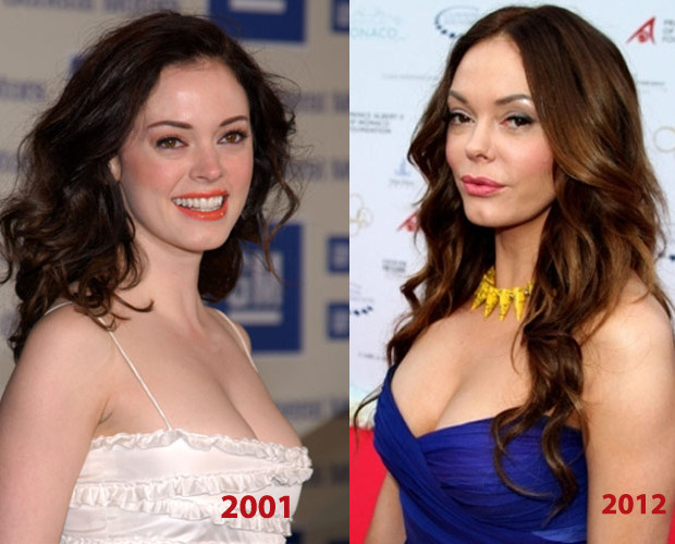 Rose McGowan