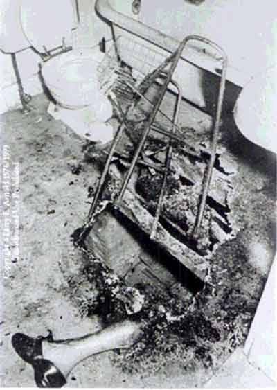 Real victim of the phenomenon known as "spontaneous human combustion".