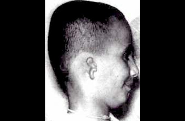 A boy in Turkey was born with unilateral microtia and hemifacial microsomia, meaning malformed and underdeveloped ear and face. Soon he recalled the life of a man he claimed was killed by a shotgun. Records from the local hospital indicated a man had died from injuries by a blast, to the right side of his skull.