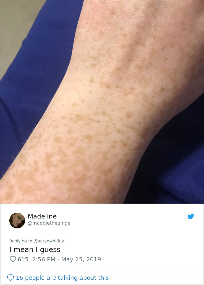 Even those who are already naturally freckled or suffer skin pigment problems are noticing a tiny, distinct freckle.