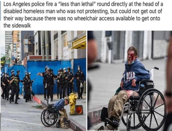wheelchair - Los Angeles police fire a "less than lethal" round directly at the head of a disabled homeless man who was not protesting, but could not get out of their way because there was no wheelchair access available to get onto the sidewalk