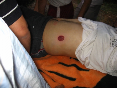 Aftermath after a rubber bullet connects.