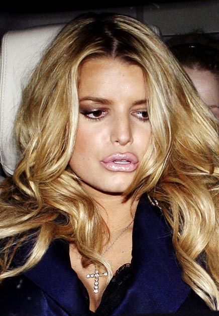 JESSICA SIMPSON While the singer has recently battled rumors of an expanding waistline, there is one thing she's admitted has plumped up: her lips! "I had that Restylane stuff," Simpson, 28, told Glamour magazine in 2006, adding that she was disappointed in the results. "It went away in like four months...[but] thank God! [They] looked fake to me. I didn't like that."