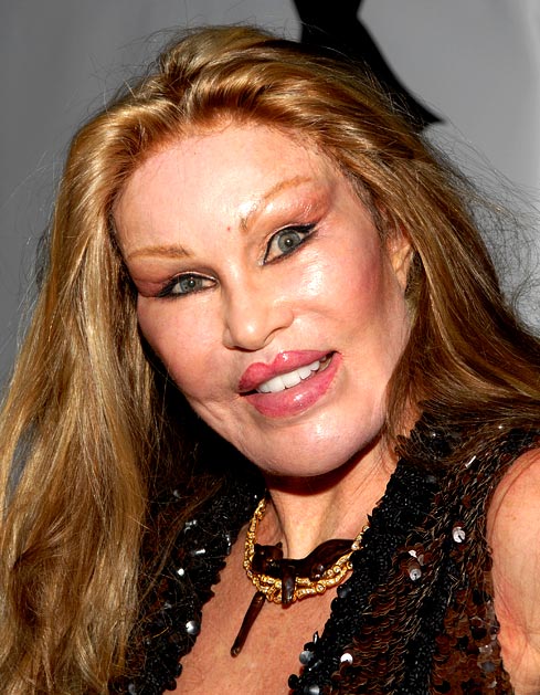JOCELYNE WILDENSTEIN Nicknamed "Catwoman" for her feline-like features, socialite Wildenstein, 62, first went under the knife in the 70's, fearing her millionaire husband would leave her if she did not change her look. Later, she admitted that the surgery was not an effort to maintain her marriage, but rather to pay homage to exotic wild cats, which her husband loved.