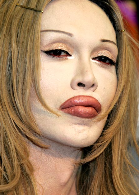 PETE BURNS The Dead or Alive singer, 49, is most famous for his song "You Spin Me Round," but is equally as known for his extensive cosmetic surgeries. Burns defended his choice to enhance his features to the Times Online, explaining that surgery is quickly becoming the norm. "Look how common [it] has become," he said. "It's the same with piercing: when I had my nose pierced in 1973, it was considered shocking. Now, housewives have everything pierced!"