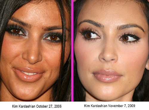 Kim Kardashian-now if only she could get a brain implant
