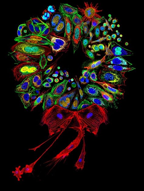 Mammalian cells dyed and arranged in the shape of a wreath - Merry Xmas
