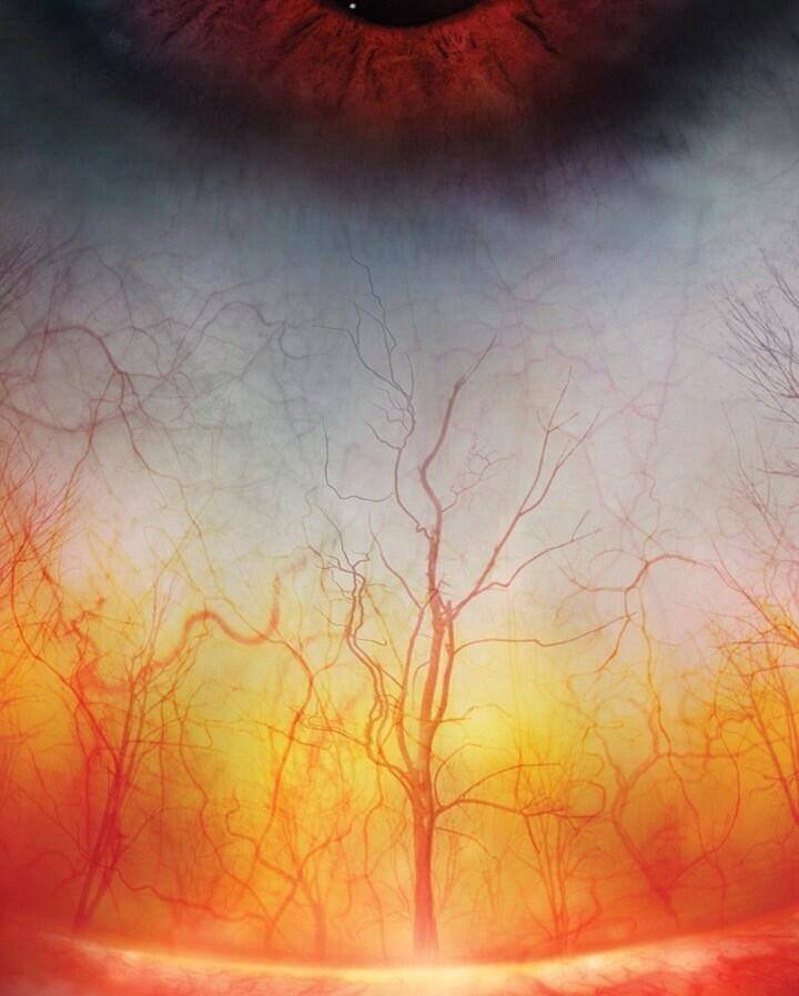 High definition photograph of the blood vessels in a human eye - looks eerily like a forest