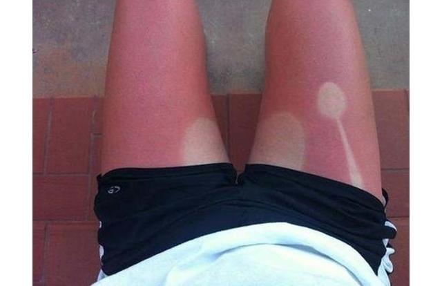 funny too much sun