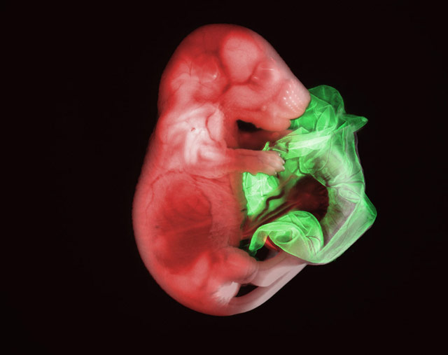 mouse embryo (18.5 days) - 17x