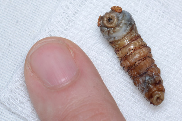 Botfly Worm - These buggers are the offspring of the botfly, which lay their eggs on people or animals, the eggs hatch and the larvae digs in under the skin. You won't notice until it's as huge as a over sized pimple that digs in your skin and you have to pull it out...
