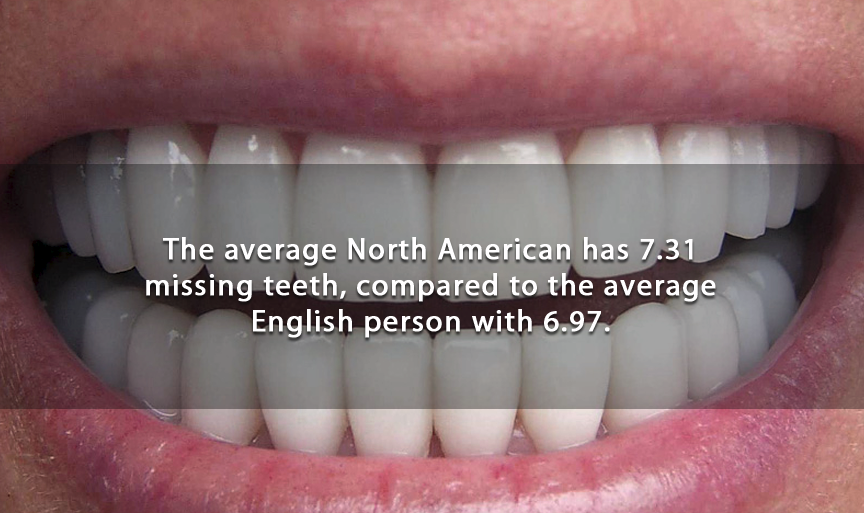 tooth - The average North American has 7.31 missing teeth, compared to the average English person with 6.97.