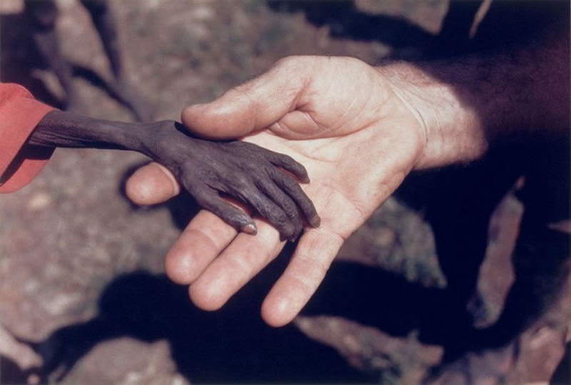 A missionary holds hands with a starving boy in Karamoja district, Uganda, 1980.