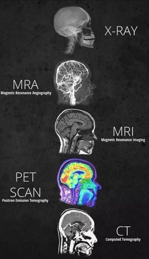 imaging techniques mcat - XRay Mra Magnetic Resonance Angiography Mri Magnetic Resonance Imaging Pet Scan Positron Emission Tomography Computed Tomography