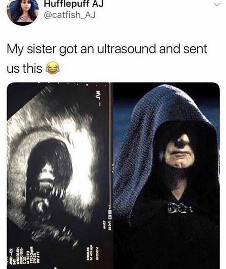 prequel memes palpatine - Hufflepuff Aj My sister got an ultrasound and sent us this Cs 110 Itcoin 001IT Bioders yosan erocer Ht Scs