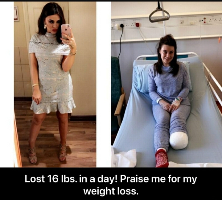 awesome pics and funny memes - shoulder - Lost 16 lbs. in a day! Praise me for my weight loss.