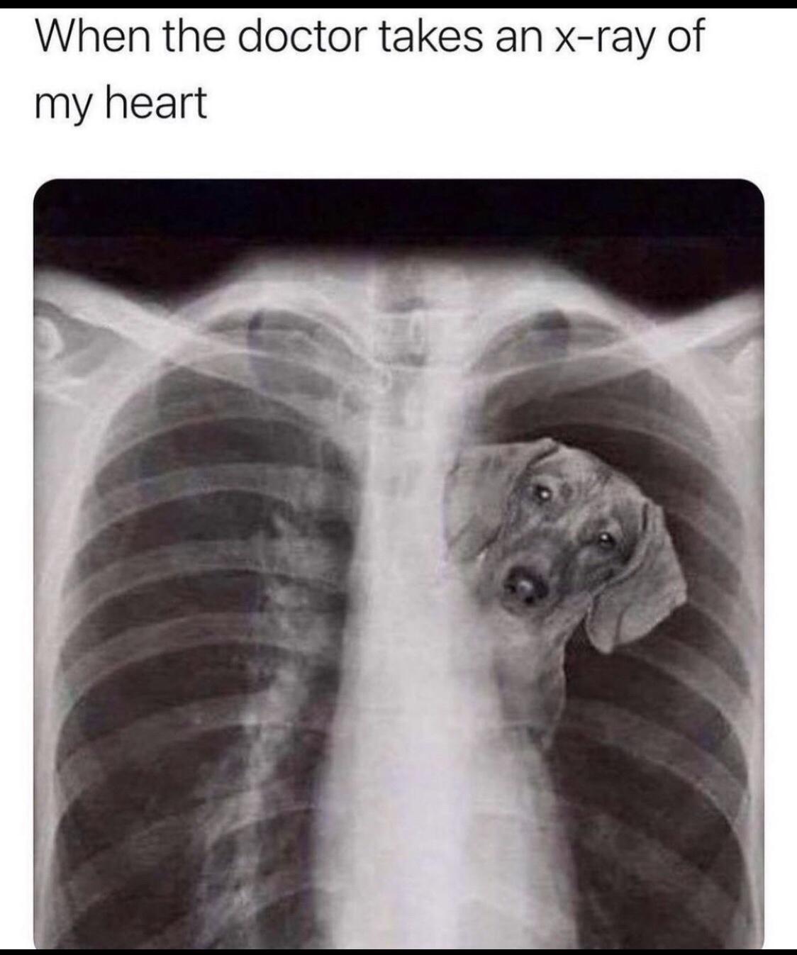 doctor take an xray of my heart meme - When the doctor takes an xray of my heart