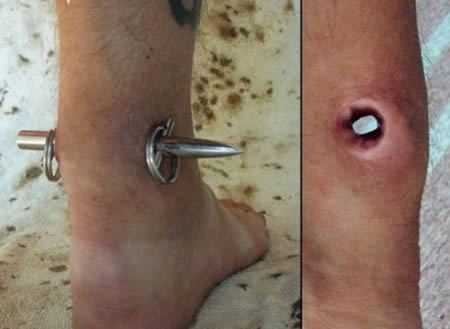 12 Most Extreme Body Piercings