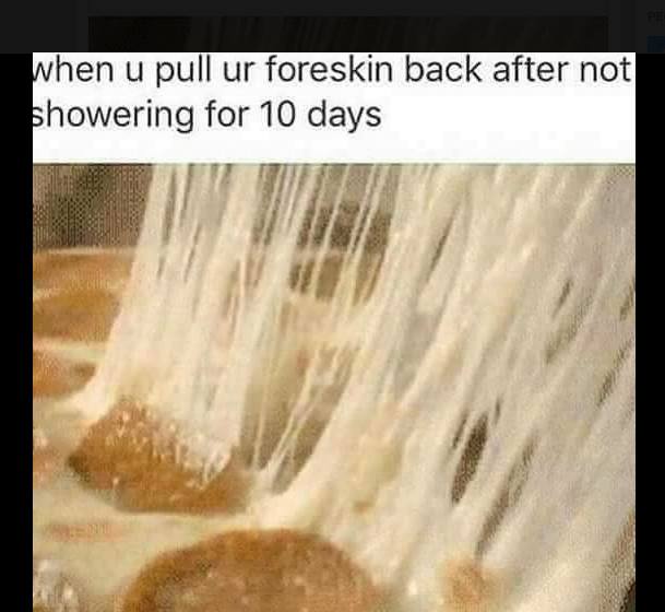 cheesy foreskin meme - when u pull ur foreskin back after not showering for 10 days