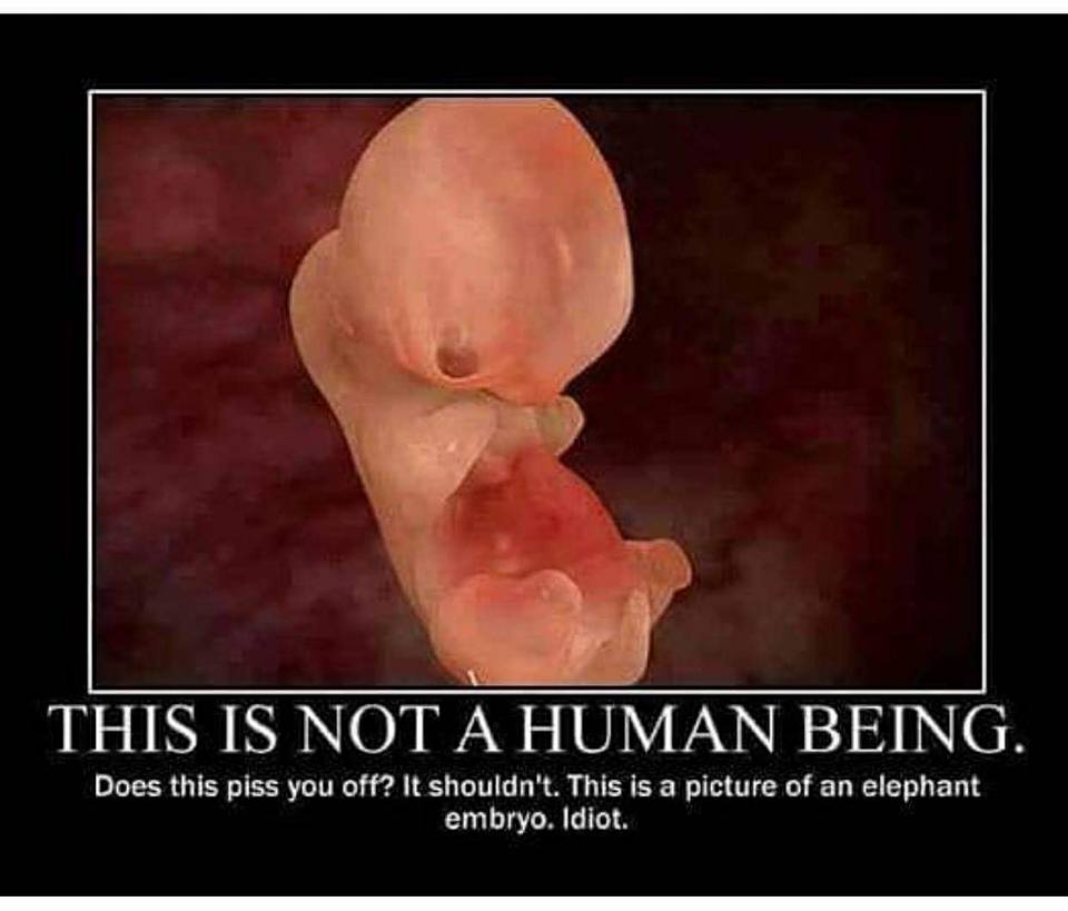 memes - elephant embryo - This Is Not A Human Being. Does this piss you off? It shouldn't. This is a picture of an elephant embryo. Idiot.
