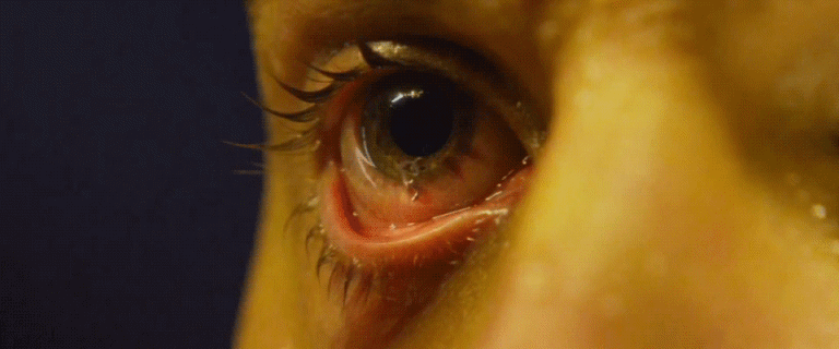 gifs - bug inside an eyeball