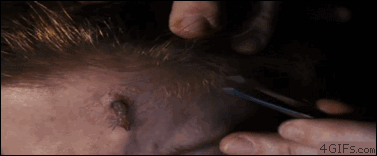 gifs - bug in a persons face