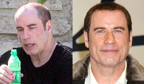 John Travolta wears a wig.
