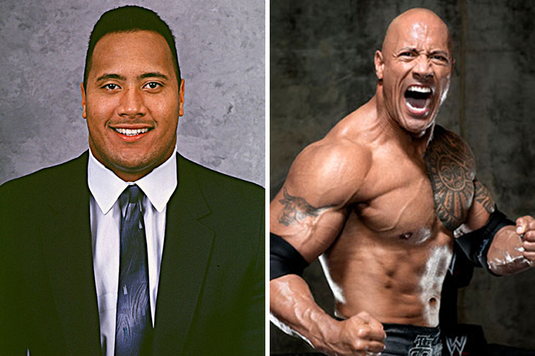 Dwayne Johnson had liposuction. The Rock found it very difficult to lose weight when he was younger due to a medical condition.