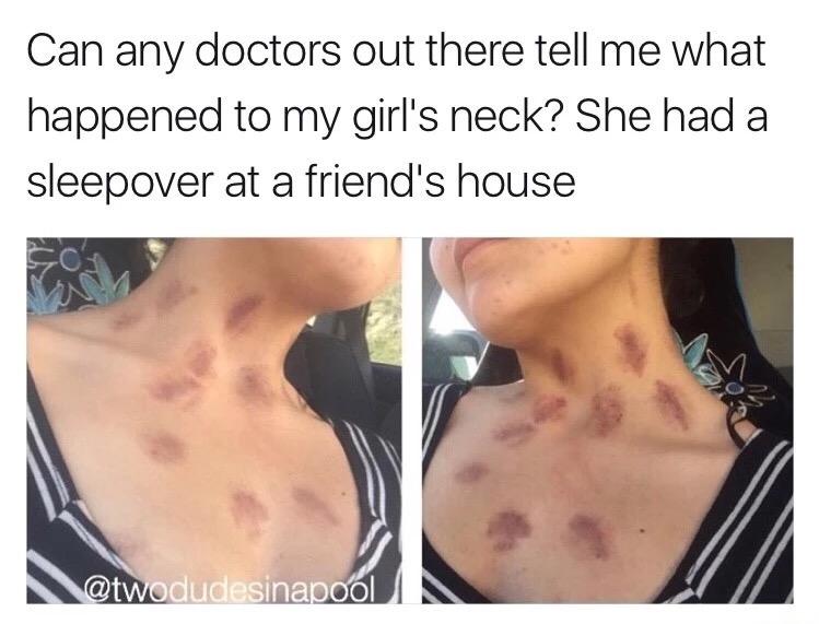 kids sleepover meme - Can any doctors out there tell me what happened to my girl's neck? She had a sleepover at a friend's house N