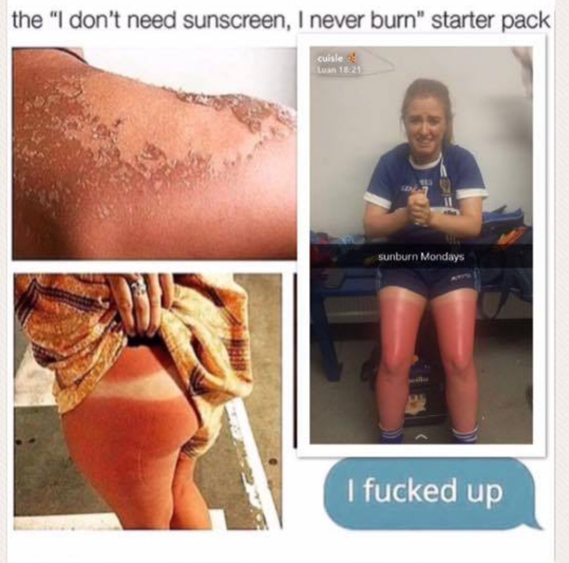I don't need sunscreen starter pack of girls burned by the sun