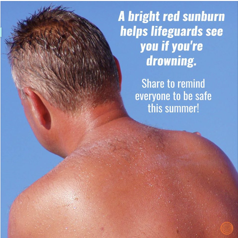 coup de soleil - A bright red sunburn helps lifeguards see you if you're drowning to remind everyone to be safe this summer!