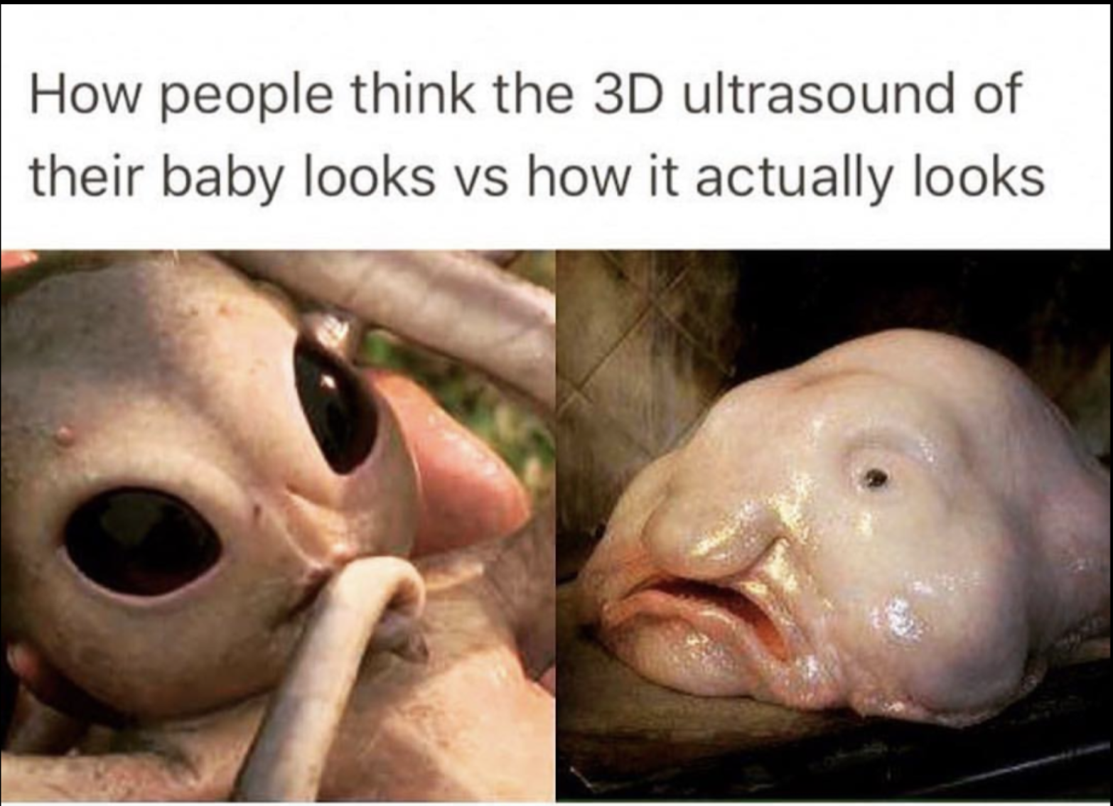 mouth - How people think the 3D ultrasound of their baby looks vs how it actually looks