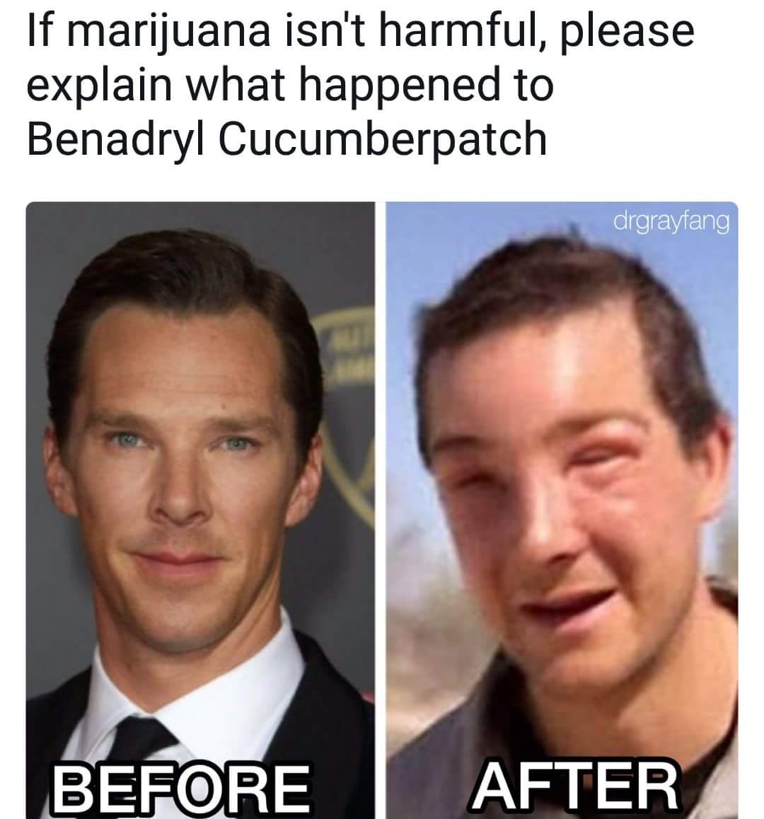 420 Meme about the dangers of smoking with example of how bad it was for Benadryl Cucumberpatch (Benedict Cumberbatch)