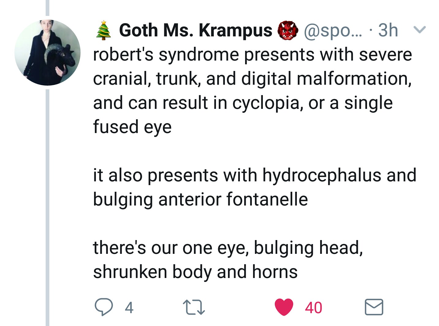 angle - Goth Ms. Krampus ... 3h v robert's syndrome presents with severe cranial, trunk, and digital malformation, and can result in cyclopia, or a single fused eye it also presents with hydrocephalus and bulging anterior fontanelle there's our one eye, b