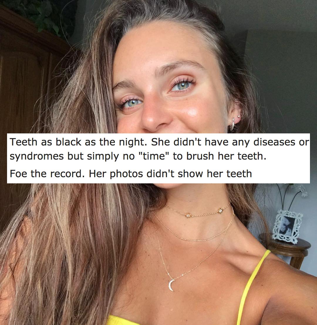 blond - Teeth as black as the night. She didn't have any diseases or syndromes but simply no "time" to brush her teeth. Foe the record. Her photos didn't show her teeth
